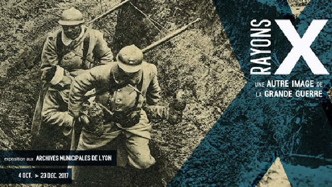 Rayons X. Une autre image de la Grande Guerre